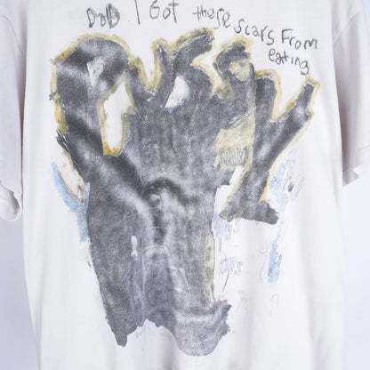 ERD SCARS FROM EATING TEE